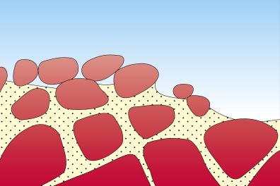 Formation d'un chaos granitique - étape 5